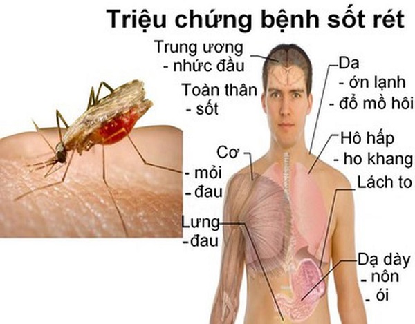 hệ lụy của bệnh sốt rét và cách phòng bênh hiệu quả