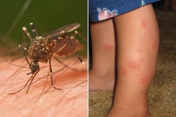 Những loài côn trùng gây hại thường xuất hiện trong nhà