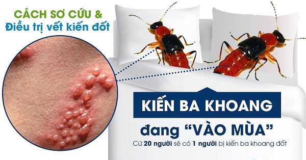 Sử dụng cửa lưới chống muỗi để đẩy lùi dịch bệnh từ côn trùng