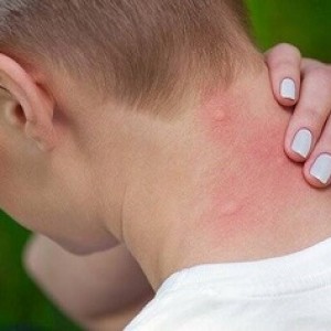 Nhận thức về muỗi và vấn đề sức khỏe do muỗi gây ra